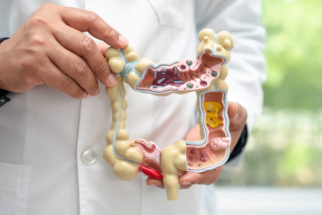 Processo di idroterapia del colon